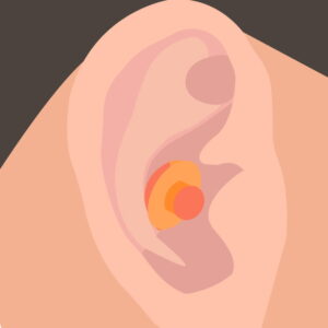 Illustration eines Ohres mit einem orangefarbenen, mehrschichtigen Ohrstöpsel im Gehörgang